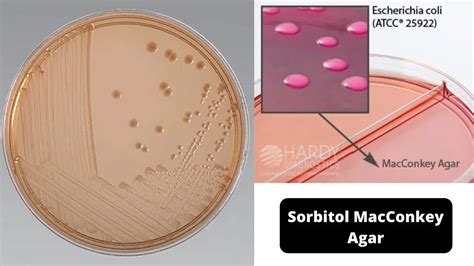 Sorbitol MacConkey Agar Composition, Preparation and Uses – Microbiology Notes