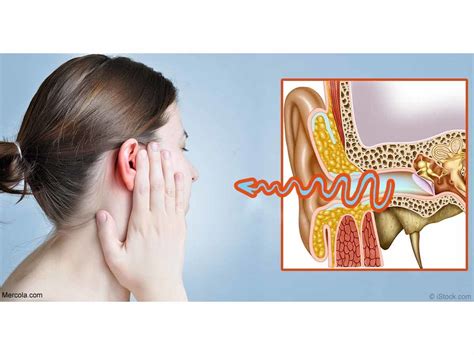 How to Safely Remove Water From Your Ear | Ramsey, NJ Patch