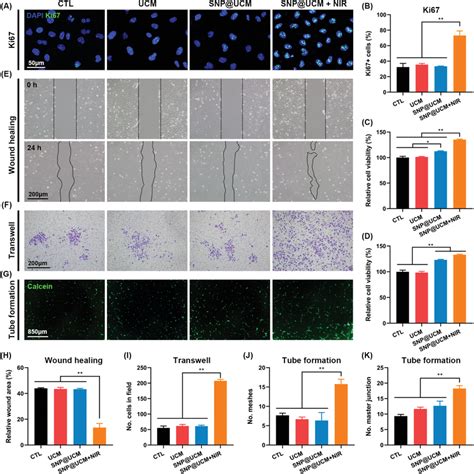 In vitro promotion of proliferation and angiogenesis of HUVECs by ...