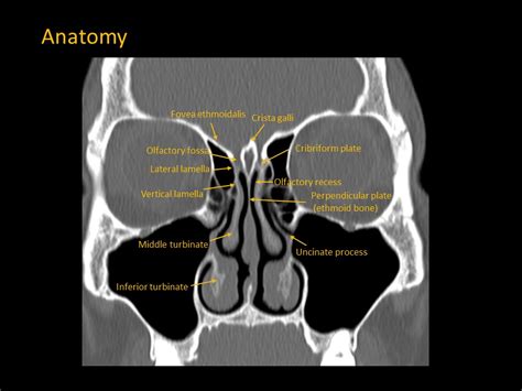 Planum Sphenoidale Anatomy