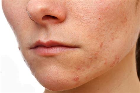 Types of Skin Problems on Face - Top 10 List - Skin Care Geeks