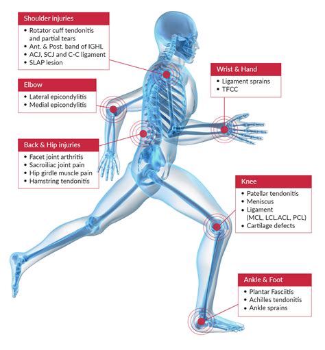 PRP Generic | Orange County Orthopedic & Podiatry Group