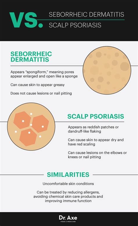 Seborrheic dermatitis vs. scalp psoriasis - Dr. Axe #PsoriasisHair | Scalp psoriasis treatment ...