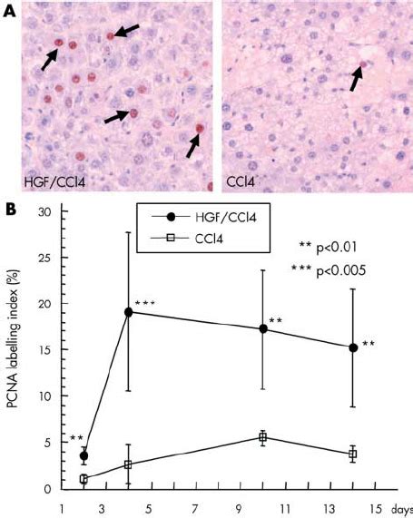 Effect of hepatocyte growth factor (HGF) on hepatic proliferation after... | Download Scientific ...