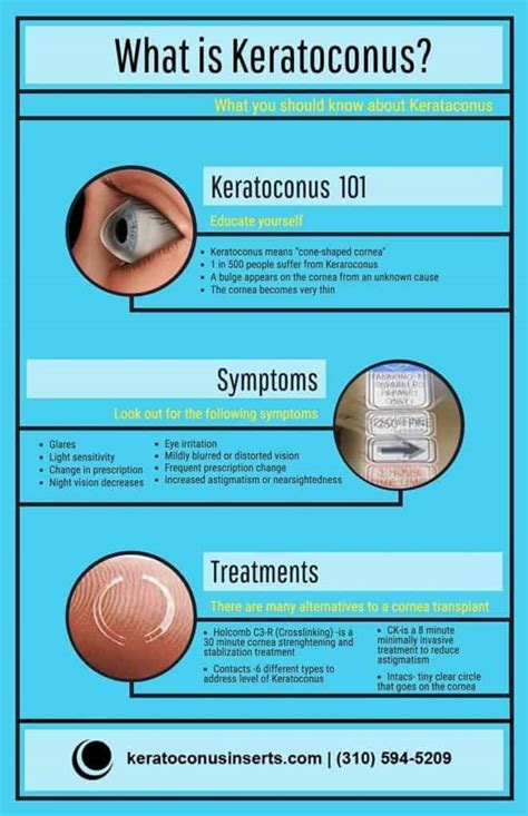 Cure for Keratoconus - Keratoconus Infographic