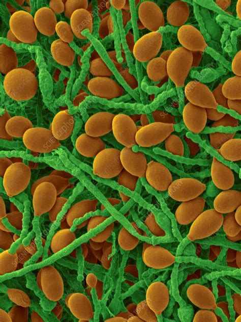 Scedosporium prolificans fungal pathogen, SEM - Stock Image - C032/3007 - Science Photo Library