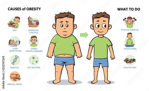 Obesity causes and prevention. Young guy before and after diet and fitness. Infographic poster ...