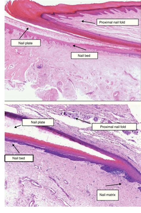 nail histology – histology nail softener – TURJN