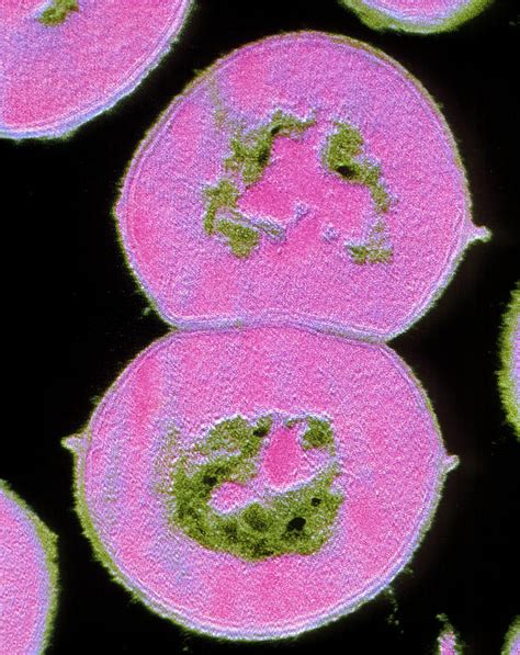 F/col Tem Of Streptococcus Viridans Photograph by Cnri