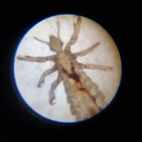 Head lice under microscope stock photo. Image of microscope - 183029926