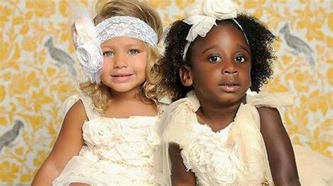 These Twins’ Skin Colors Varied When They Were Born; See How They Appear 20 Years Later - Just ...