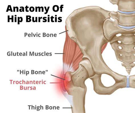 Hip Bursitis: Why Low Back Dysfunction is the Missing Piece of the Puzzle | Your Wellness Nerd ...