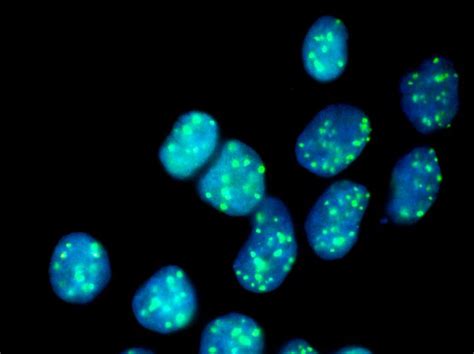 HAP1 Cells Lacking FANCC Gene [IMAGE] | EurekAlert! Science News Releases