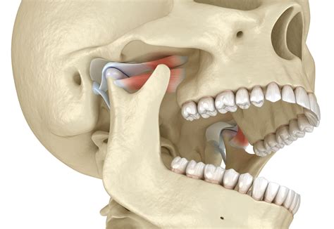 When Your Jaw Joints Don’t Work Properly Anymore | Cedar Rapids, IA