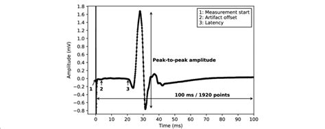 Single MEP An example of a single motor evoked potential (MEP)... | Download Scientific Diagram