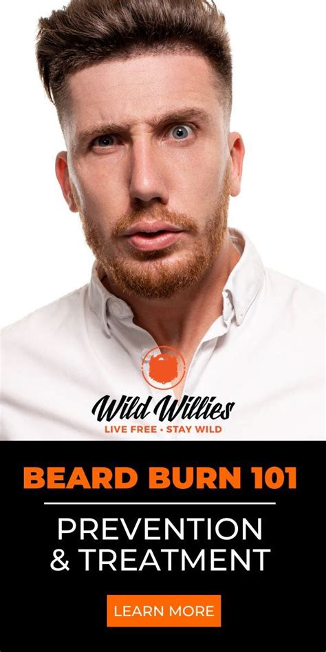 What is Beard Burn And How To Prevent and Treat It in 2020 | Beard burn, Best beard oil, Beard care