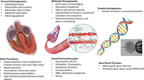 Hypertrophic cardiomyopathy: the future of treatment - Tuohy - 2020 ...