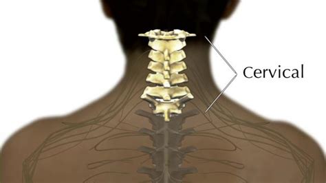 Levels of Injury: High Cervical on Vimeo