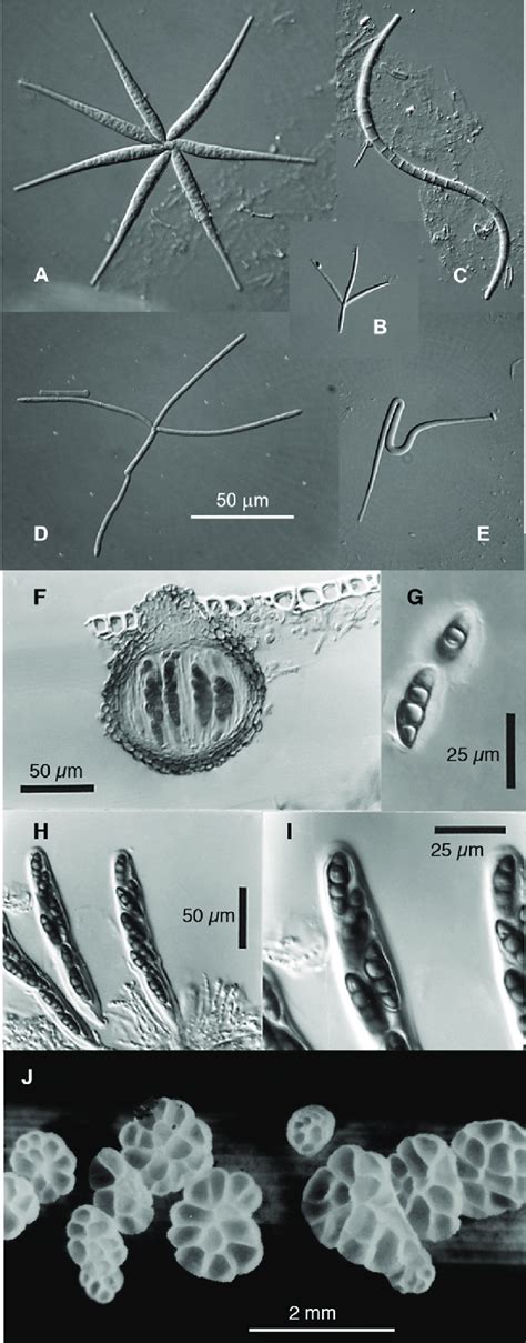 e Spores of the aquatic hyphomycetes, Flabellospora sp. (A), Alatospora ...