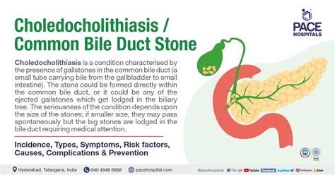 Choledocholithiasis, CBD Stone - Symptoms, Causes, Complications