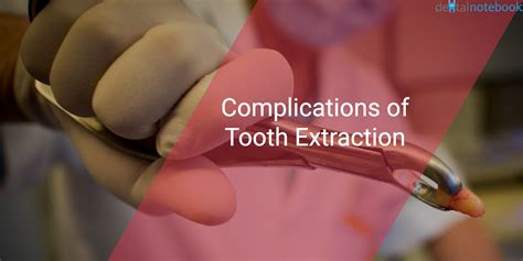 Complications of Tooth Extraction - dentalnotebook