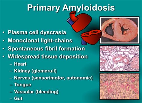 What is Amyloidosis? | Strive For Good Health