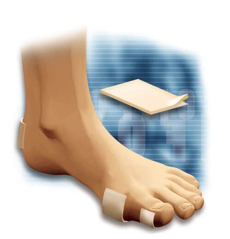 181 Hammer Toe Splint – Ortho Active