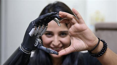 Bionic arm helps guide cling to life - Türkiye News