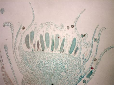 Difference Between Antheridia and Archegonia | Compare the Difference ...