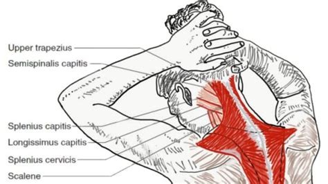 Cervical Neck Muscles