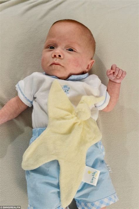 Meet Theo The Smallest Baby Boy Ever Born Weighing 350g – The Same As A ...