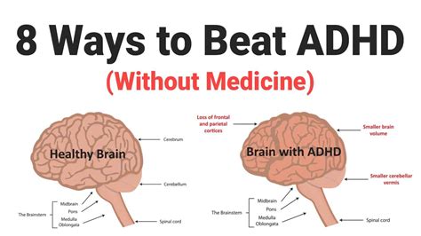 8 Ways to Beat ADHD (Without Medicine)