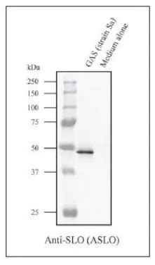 Anti-Streptolysin O antibody (GTX64171) | GeneTex