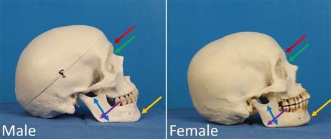 [Figure, Differences between male and female...] - StatPearls - NCBI ...