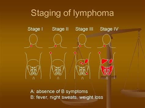 Lymphoma Haematological Neoplasia — Overview n Leukemias