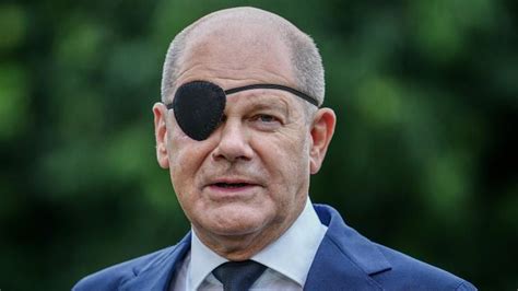 Olaf Scholz legt Augenklappe wieder ab: So sieht sein Auge aus | SHZ