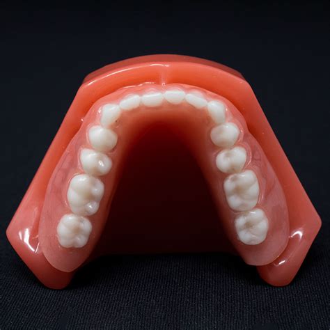 Fully Edentulous Mandible Model with Denture - BoneModels™