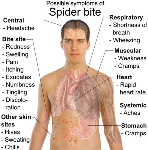 Here's what happens inside your body when you get bitten by a black widow. Spider Bite Symptoms ...