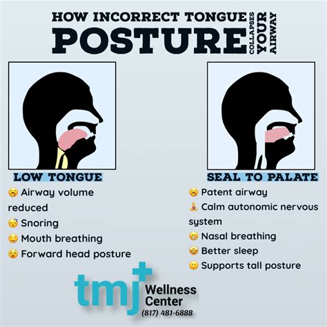 When your tongue is positioned in the wrong way, it blocks your airway. This can lead to snoring ...