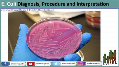 E. Coli (Escherichia coli) | Lab Tests Guide