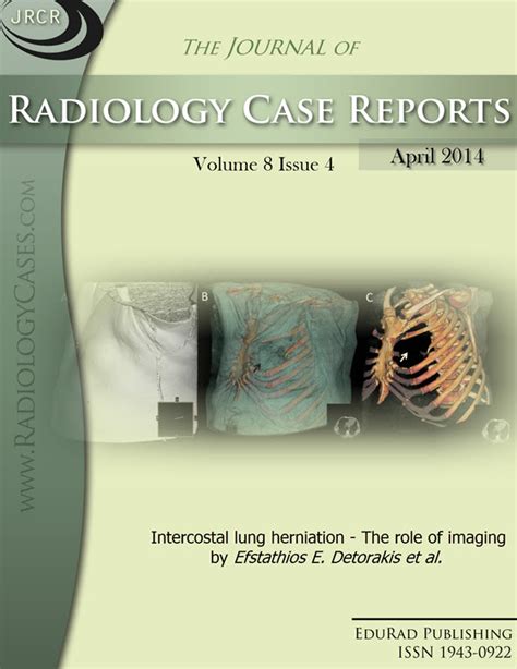 Vol 8, No 4 (2014) | Free journal access | Radiology Journal