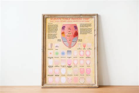 Ayurveda Tongue Diagnosis Poster Ayurveda Tongue Chart - Etsy