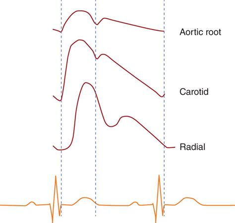 Hemodynamic Monitoring | Anesthesia Key