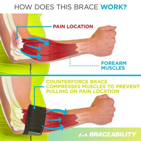 Tendonitis Counterforce Brace | Tennis & Golfers Elbow Support Strap