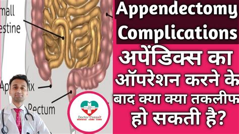 Appendectomy Complications। अपेंडिक्स का ऑपरेशन करने के बाद क्या क्या ...