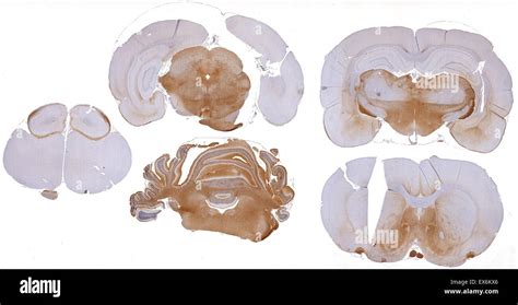 Calretinin: Immunoperoxidase staining of formalin-fixed, paraffin-embedded mouse brain showing ...