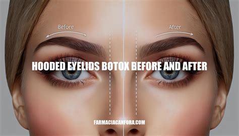 Hooded Eyelids Botox Before and After: A Comprehensive Guide