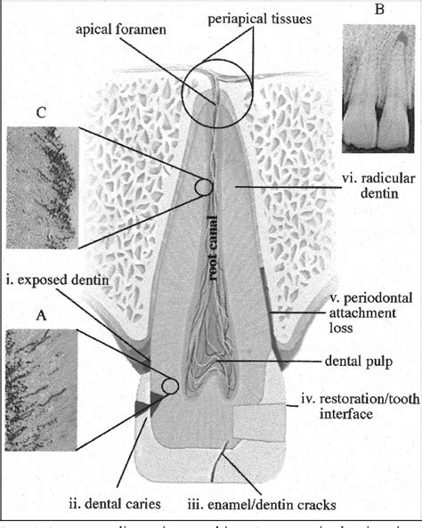 Figure 2 from Invasion of dentinal tubules by oral bacteria. | Semantic Scholar