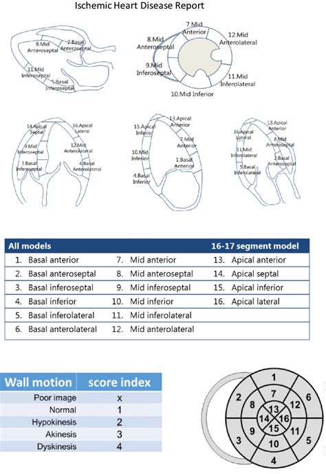 Professional Echocardiogram Report Template PDF Example | Stableshvf