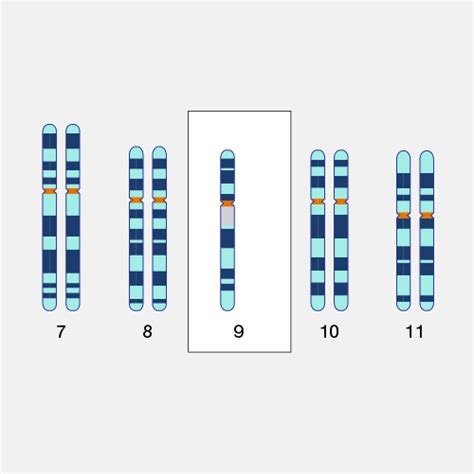 Monosomy